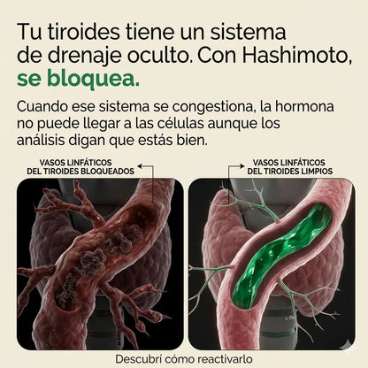 Tratamiento Tiroides - Sculptique™
